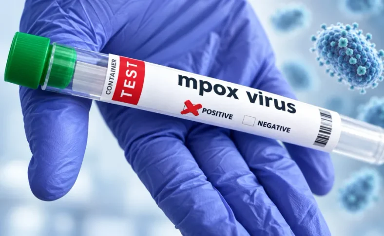 KP reports four new mpox cases, provincial tally rises to 18